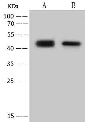 Western Blot: Human Coronavirus Nucleocapsid Protein Antibody [NBP3-12767]
