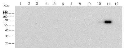 Western Blot: Human Coronavirus Spike Protein Antibody (05) [NBP3-14664]