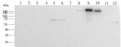 Western Blot: Human Coronavirus Spike Protein Antibody (06) [NBP3-14654]