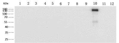 Western Blot: Human Coronavirus Spike Protein Antibody (11) [NBP3-14653]