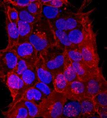 Immunocytochemistry/ Immunofluorescence: Human ESC Marker Antibody Pack [NBP1-42825]