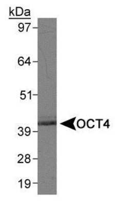 Western Blot: Human ESC Marker Antibody Pack [NBP1-42825]