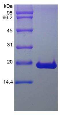 SDS-PAGE: Recombinant Human FGF-10 Protein [NBP2-34927]