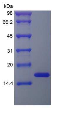 SDS-PAGE: Recombinant Human FGF basic/FGF2/bFGF Protein [NBP2-34921]