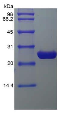 SDS-PAGE: Recombinant eGFP Protein [NBP2-34923]