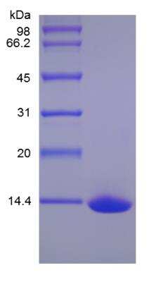 SDS-PAGE: Recombinant Human GITR Ligand/TNFSF18 Protein [NBP2-35053]