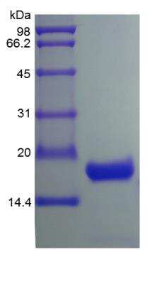 SDS-PAGE: Recombinant Human IL-10 Protein [NBP2-35015]