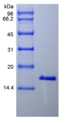 SDS-PAGE: Recombinant Human IL-21 Protein [NBP2-35057]
