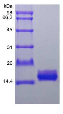 SDS-PAGE: Recombinant Human IL-36Ra/IL-1F5 Protein [NBP2-34872]