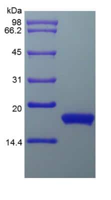 SDS-PAGE: Recombinant Human IFN-alpha 2 (alpha 2b) Protein [NBP2-34971]
