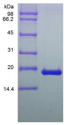 SDS-PAGE: Recombinant Human LIF Protein [NBP2-34935]