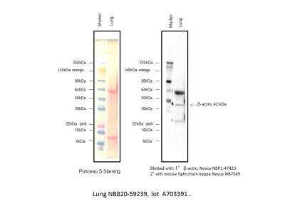 Western Blot: Human Lung Whole Tissue Lysate (Adult Whole Normal) [NB820-59239]
