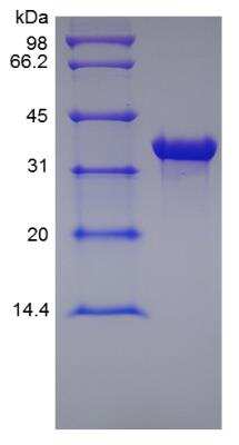 SDS-PAGE: Recombinant Human MICA Protein [NBP2-34988]
