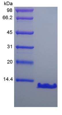 SDS-PAGE: Recombinant Human PTH Protein [NBP2-35216]
