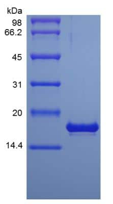 SDS-PAGE: Recombinant Human Pleiotrophin/PTN Protein [NBP2-35233]