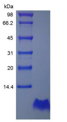 SDS-PAGE: Recombinant Human Proinsulin C-Peptide Analogue Protein [NBP2-35211]