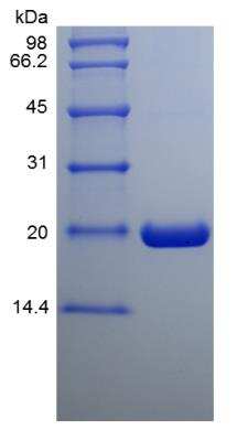 SDS-PAGE: Recombinant Human UbcH10/UBE2C His (N-Term) Protein [NBP2-35090]
