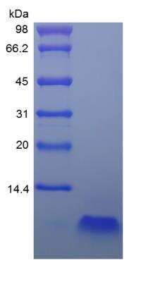 SDS-PAGE: Recombinant Human beta-Defensin 4/2 Protein [NBP2-34915]