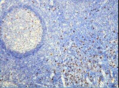 Immunohistochemistry-Paraffin: Lambda Light Chain Antibody (K22-Y) [NBP1-30142]