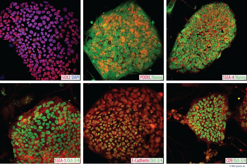 Expression of Pluripotency Markers in Human Induced Pluripotent Stem Cells. 