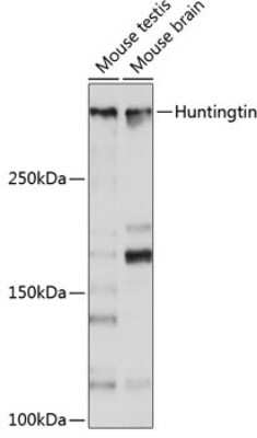 Western Blot: Huntingtin Antibody (7B9C8) [NBP3-15642]