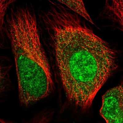 Immunocytochemistry/ Immunofluorescence: Huntingtin Antibody [NBP1-89710]
