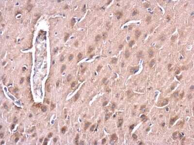 Immunohistochemistry-Paraffin: Huntingtin Antibody [NBP3-13106]