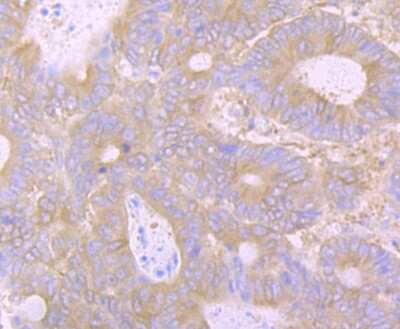 Immunohistochemistry-Paraffin: Huntingtin Antibody (JB89-34) [NBP2-75531]