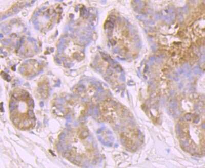 Immunohistochemistry-Paraffin: Huntingtin Antibody (JB89-34) [NBP2-75531]