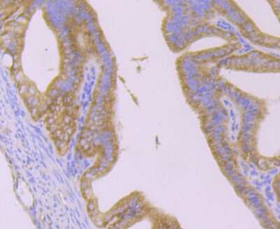Immunohistochemistry-Paraffin: Huntingtin Antibody (JB89-34) [NBP2-75531]