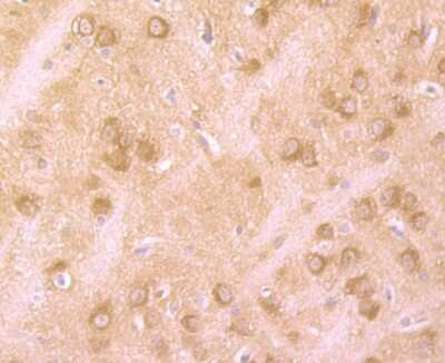 Immunohistochemistry-Paraffin: Huntingtin Antibody (JB89-34) [NBP2-75531]