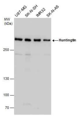 Western Blot: Huntingtin Antibody [NBP3-13106]