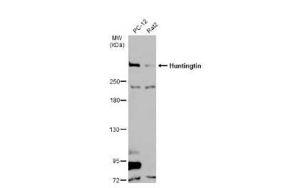 Western Blot: Huntingtin Antibody [NBP3-13106]