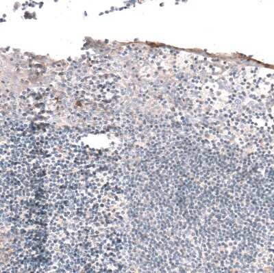 Immunohistochemistry-Paraffin: Hyaluronan Synthase 3/HAS3 Antibody [NBP1-86328]