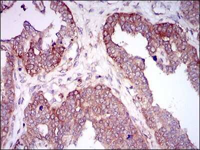 Immunohistochemistry-Paraffin: Hyaluronan synthase 2 Antibody (4E7) - BSA Free [NBP2-37446]