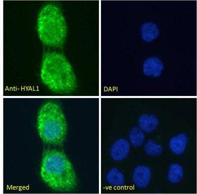 Immunofluorescence: Hyaluronidase 1/HYAL1 Antibody [NBP1-00201]