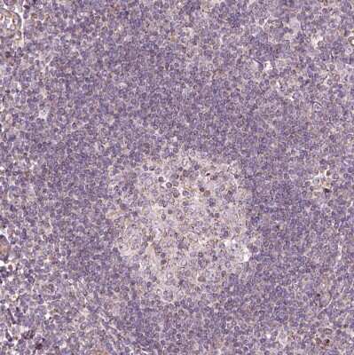 Immunohistochemistry-Paraffin: Hyaluronidase 1/HYAL1 Antibody [NBP1-83409]