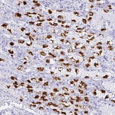 Immunohistochemistry: Hydrogen Potassium ATPase Beta Antibody [NBP2-32035]