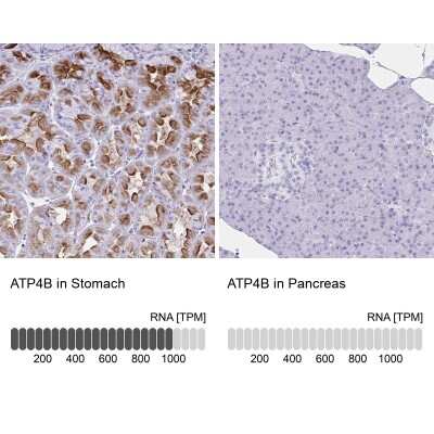 Immunohistochemistry-Paraffin: Hydrogen Potassium ATPase Beta Antibody [NBP2-32035]