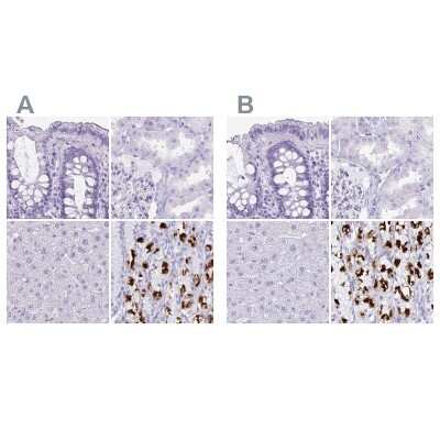 Immunohistochemistry-Paraffin: Hydrogen Potassium ATPase Beta Antibody [NBP2-32035]