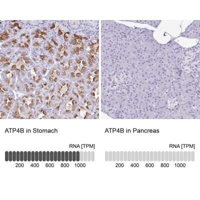 Immunohistochemistry-Paraffin: Hydrogen Potassium ATPase Beta Antibody [NBP2-38674]