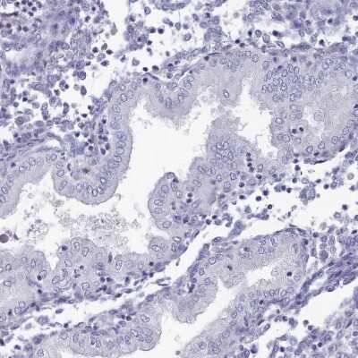 Immunohistochemistry-Paraffin: Hydroxyacid Oxidase-1/HAO-1 Antibody [NBP2-14080]