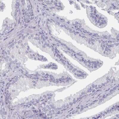 Immunohistochemistry-Paraffin: Hydroxyacid Oxidase-1/HAO-1 Antibody [NBP2-14080]