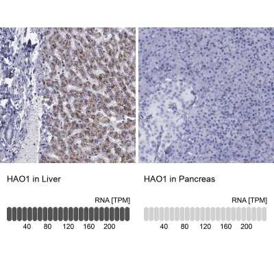 Immunohistochemistry-Paraffin: Hydroxyacid Oxidase-1/HAO-1 Antibody [NBP3-16999]