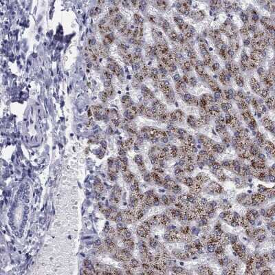 Immunohistochemistry-Paraffin: Hydroxyacid Oxidase-1/HAO-1 Antibody [NBP3-16999]