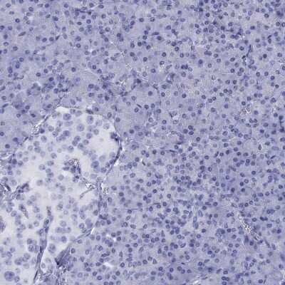 Immunohistochemistry-Paraffin: Hydroxyacid Oxidase-1/HAO-1 Antibody [NBP3-16999]
