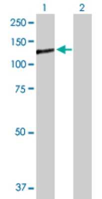 Western Blot: IA-2/PTPRN Antibody [H00005798-D01P]