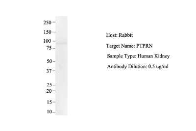 Western Blot: IA-2/PTPRN Antibody [NBP1-59411]