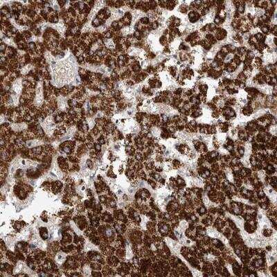 Immunohistochemistry: IBRDC1 Antibody [NBP1-88253]