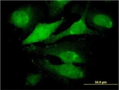Immunocytochemistry/ Immunofluorescence: IBRDC2 Antibody (4F1) [H00255488-M02]